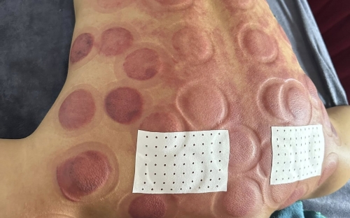 Giữ gìn sức khỏe mùa mưa nắng thất thường – Chia sẻ từ Mai Dung Beauty Spa