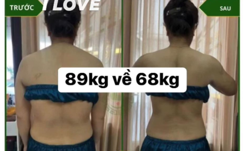 Giảm mỡ – Siết eo: Giải pháp vòng eo thon gọn chỉ sau 1 buổi tại Mai Dung Beauty Spa