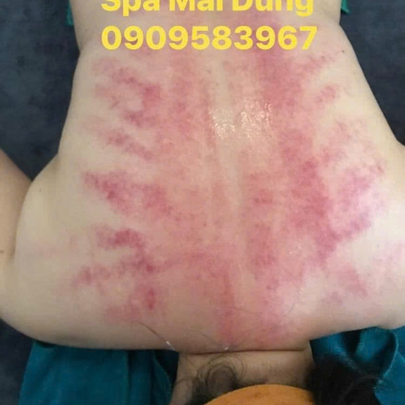 Trị liệu cổ vai gáy, Xoa bóp bấm huyệt, Giác hơi bài hàn, Gội đầu dưỡng sinh, Siết eo giảm béo Trung Hoa