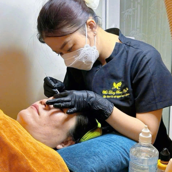 3 Nguyên Tắc Trị Mụn Bạn ' Bắt Chước ' Phải Nhớ