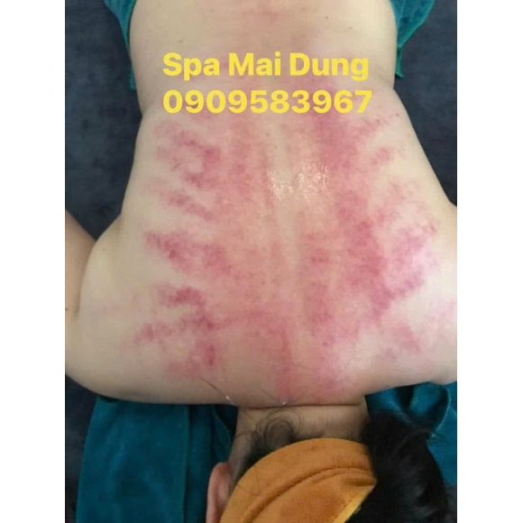 Trị liệu cổ vai gáy, Xoa bóp bấm huyệt, Giác hơi bài hàn, Gội đầu dưỡng sinh, Siết eo giảm béo Trung Hoa