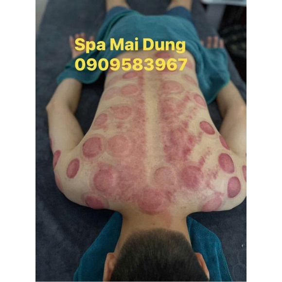 Trị liệu cổ vai gáy, Xoa bóp bấm huyệt, Giác hơi bài hàn, Gội đầu dưỡng sinh, Siết eo giảm béo Trung Hoa