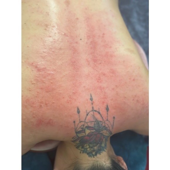 Trị liệu cổ vai gáy, Xoa bóp bấm huyệt, Giác hơi bài hàn, Gội đầu dưỡng sinh, Siết eo giảm béo Trung Hoa