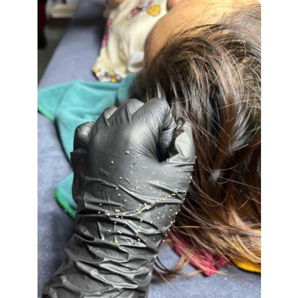 3 Nguyên Tắc Trị Mụn Bạn ' Bắt Chước ' Phải Nhớ